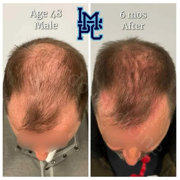 Topical Hair Treatment case 10