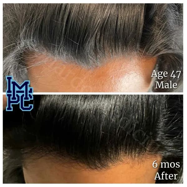 Topical Hair Treatment case 11