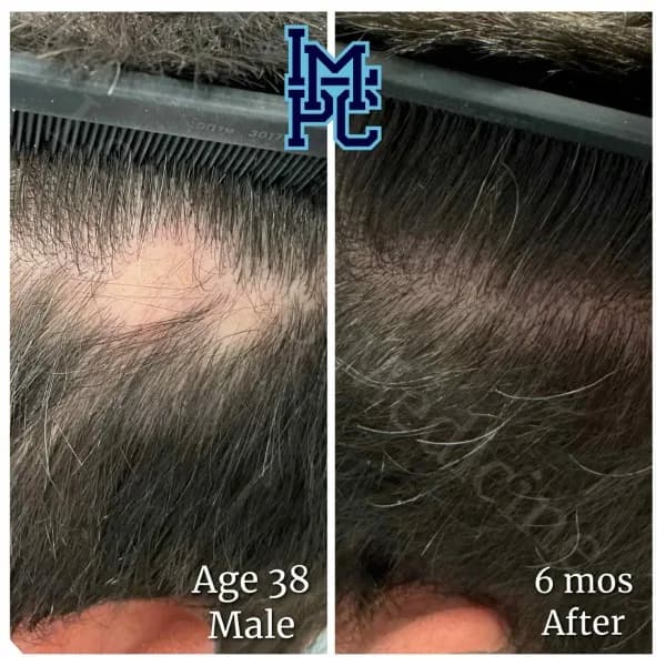 Topical Hair Treatment case 14