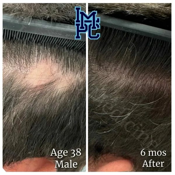 Topical Hair case 14