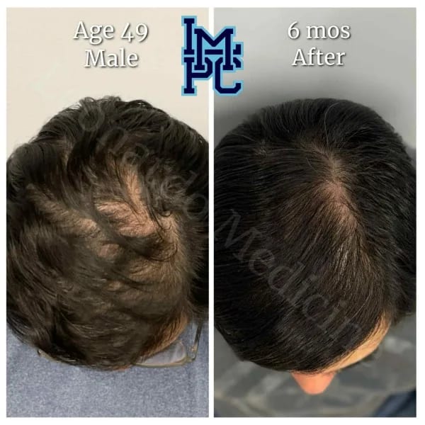 Topical Hair case 15