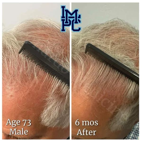 Topical Hair Treatment case 5