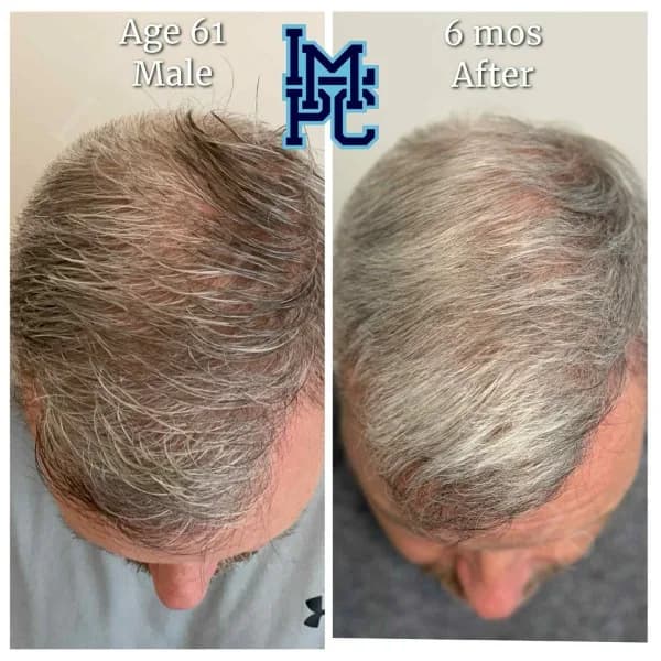 Topical Hair Treatment case 7