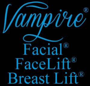 Vampire® Procedure
