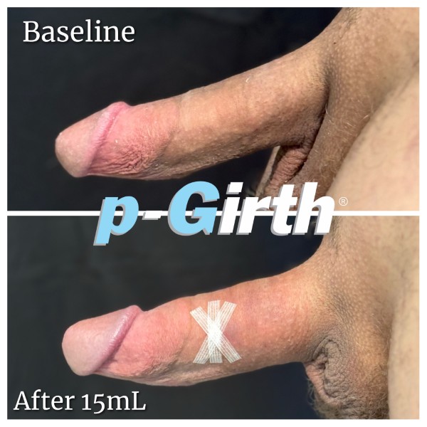 P-Girth® Cut case 17