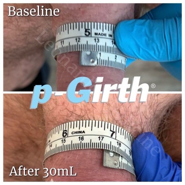 P-Girth® Cut case 18