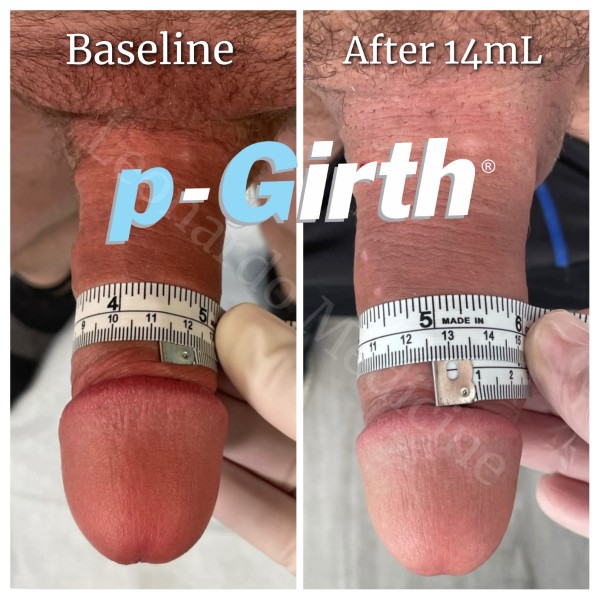 P-Girth® Cut case 21