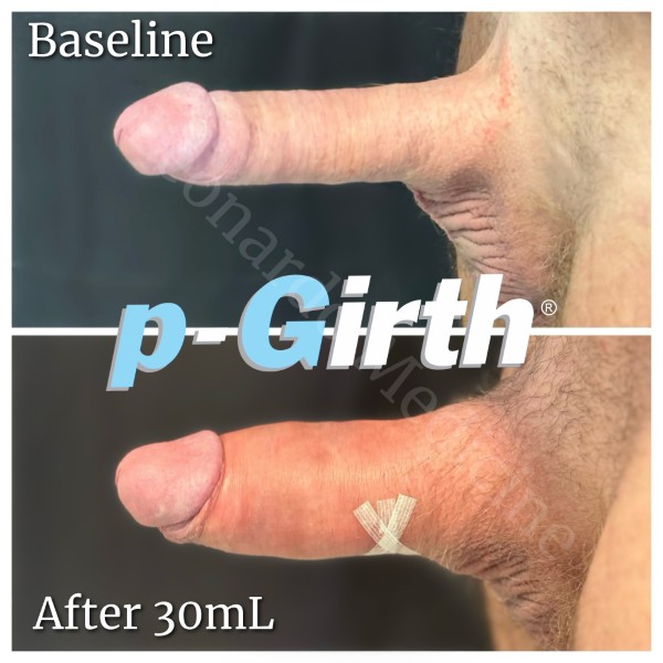 P-Girth® Cut case 5