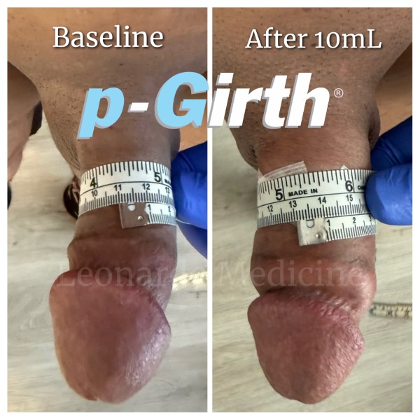 P-Girth® Cut case 9