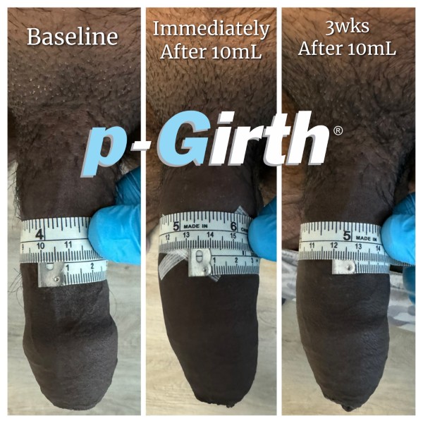 P-Girth Retention case 26