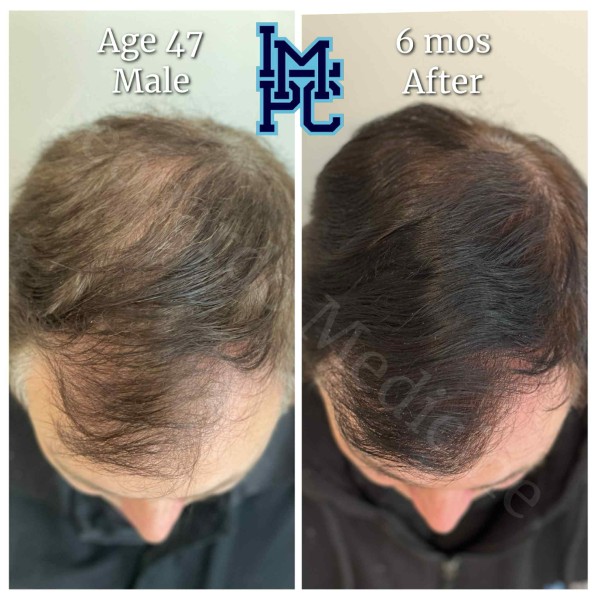 Topical Hair Treatment case 2