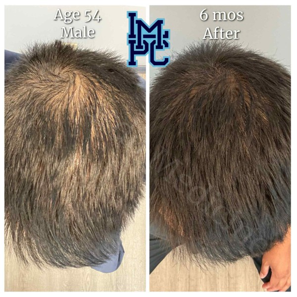 Topical Hair Treatment case 3