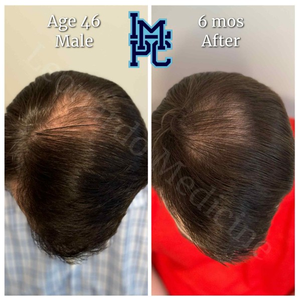 Topical Hair Treatment case 8
