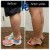 Body Tox treatment 11 thumbnail