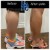 Body Tox treatment 13 thumbnail