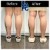 Body Tox treatment 18 thumbnail