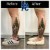 Body Tox treatment 20 thumbnail