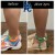 Body Tox treatment 7 thumbnail