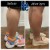 Body Tox treatment 9 thumbnail