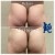 Butt Lift treatment 18 thumbnail