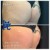 Butt Lift treatment 23 thumbnail