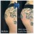 Butt Lift treatment 25 thumbnail