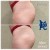 Butt Lift treatment 9 thumbnail