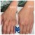 Dilute Radiesse treatment 22 thumbnail