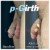 P-Girth® Cut case 30 thumbnail
