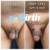 P-Girth Retention case 5 thumbnail