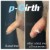 P-Girth® Uncircumcised penis augmentation case 16 thumbnail
