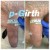 P-Girth® Uncircumcised penis augmentation case 28 thumbnail