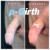P-Girth® Uncircumcised penis augmentation case 7 thumbnail