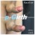 P-Girth® Uncircumcised penis augmentation case 9 thumbnail