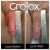 GroTox® treatment 11 thumbnail