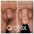 GroTox® treatment 12 thumbnail