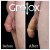 GroTox® treatment 14 thumbnail