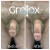 GroTox® treatment 15 thumbnail