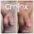 GroTox® treatment 17 thumbnail