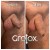 GroTox® treatment 2 thumbnail