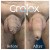 GroTox® treatment 22 thumbnail