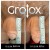 GroTox® treatment 23 thumbnail