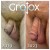 GroTox® treatment 25 thumbnail