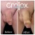 GroTox® treatment 29 thumbnail