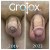 GroTox® treatment 8 thumbnail