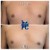 Lipodissolve treatment 3 thumbnail