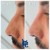 Middle Face Filler treatment 1 thumbnail