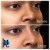 Middle Face Filler treatment 3 thumbnail