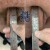 Priapus® Shot treatment case 3 thumbnail