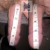 Priapus® Shot treatment case 5 thumbnail